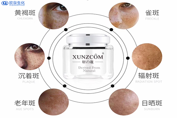 皮膚黑、長(zhǎng)斑...祛斑路上的4大絆腳石-歐泉生化
